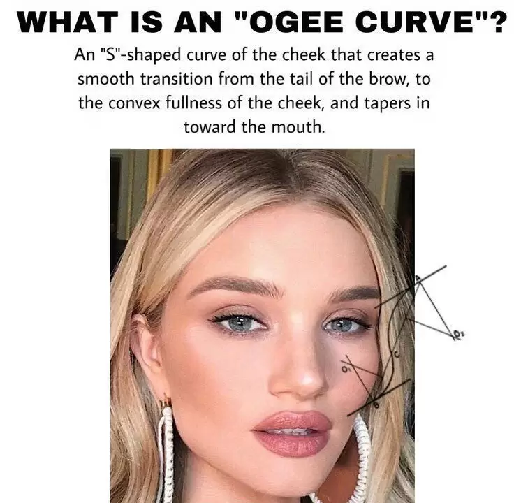 Ogee curve یکی از پترن‌های تزریق گونه