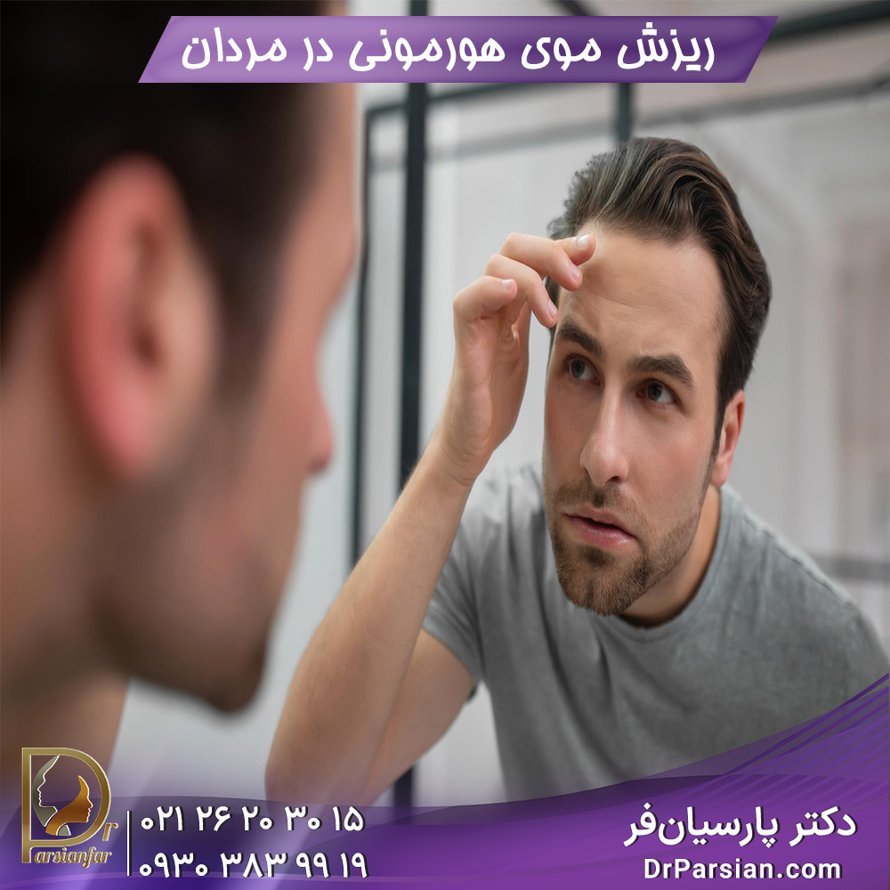 ریزش موی هورمونی در مردان